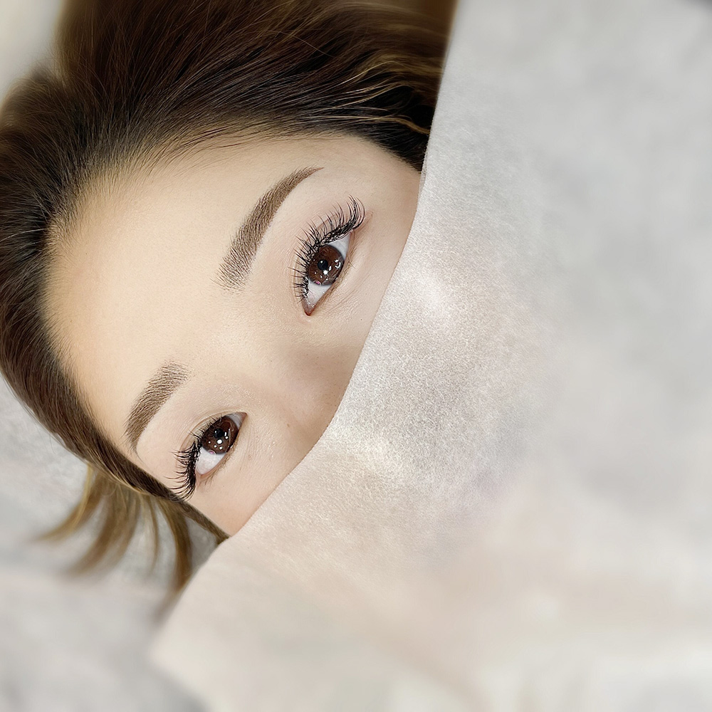 症例用画像_眉2
